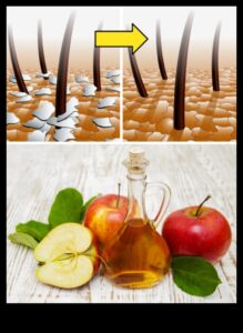 DIY ACV Adventures: Δημιουργία μοναδικών και γευστικών παρασκευασμάτων υγείας